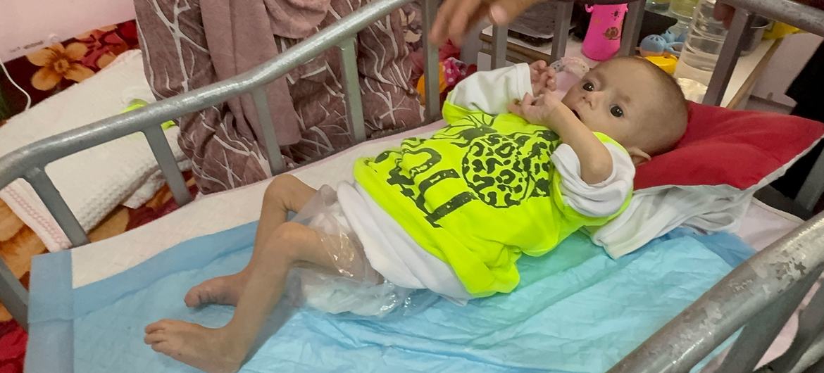 Un recién nacido recibe tratamiento por desnutrición en el hospital Nasser de Gaza.