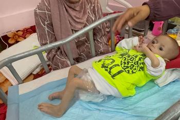Un recién nacido recibe tratamiento por desnutrición en el hospital Nasser de Gaza.
