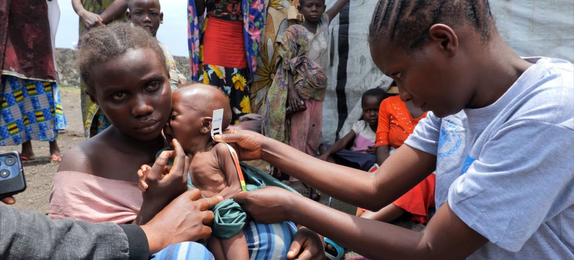 Un trabajador sanitario atiende a un niño desnutrido en el este de la República Democrática del Congo.