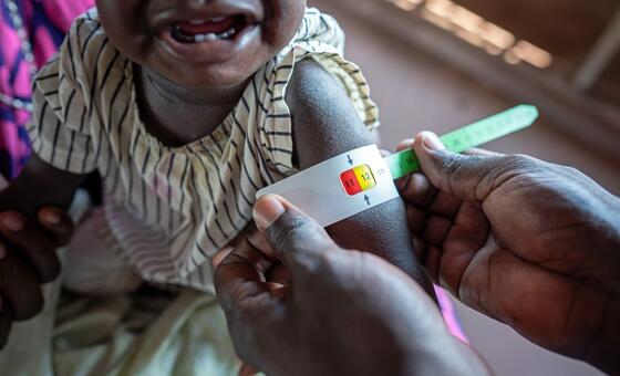 Two-thirds of global hunger concentrated in 10 conflict-hit countries