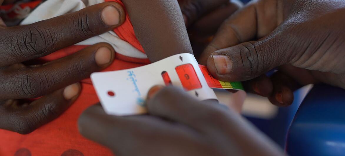 A close-up of hands using a measuring tape to assess a child's arm circumference at a UNICEF-supported nutrition center in Tawila, North Darfur, Sudan, for early detection of malnutrition.