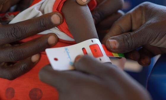 A child is screened for malnutrition at a UNICEF-supported nutrition centre in North Darfur, Sudan in December 2025. The red color signifies Severe Acute Malnutrition (SAM).