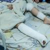 Les bombardements ont tué la mère de Milana, âgée de six ans. Elle se rétablit actuellement après avoir été opérée dans un hôpital pour enfants à Kiev, en Ukraine.