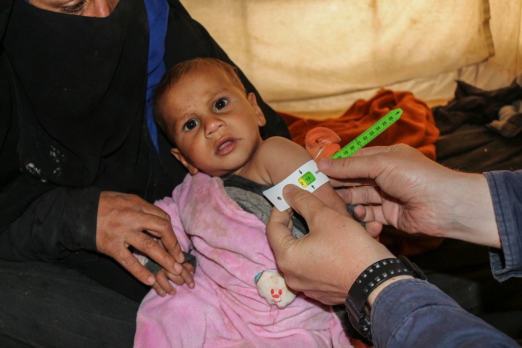 Vérification sur un bébé de signes de malnutrition au camp d'Al Hol, dans le nord de la Syrie.