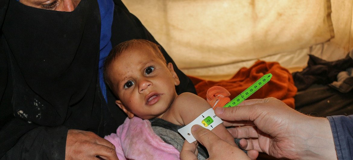 उत्तरी सीरिया के अल-होल शिविर में एक बच्चे की स्वास्थ्य जाँच की जा रही है.