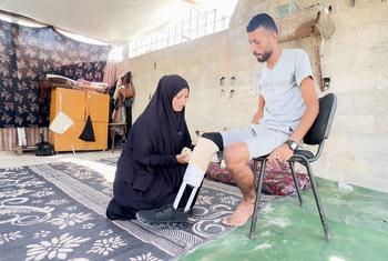 Ibrahim Abdel Nabi, un palestino desplazado en Gaza, sentado en una silla mientras su esposa le ayuda a ponerse la prótesis hecha a mano.