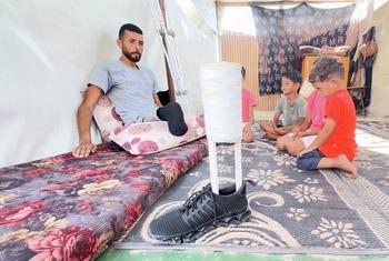 يجلس الفلسطيني إبراهيم عبد النبي في مأوى مؤقت في غزة مع أطفاله، وينظر إلى طرف صناعي صنعه بنفسه.