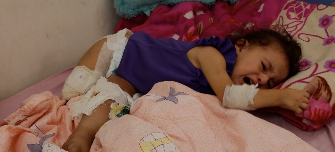 La niña palestina Maryam Abu ‘Alba yace en una cama de hospital en Gaza; su pierna derecha ha sido amputada y la izquierda está gravemente herida.