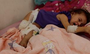 La niña palestina Maryam Abu 'Alba yace en una cama de hospital en Gaza; su pierna derecha ha sido amputada y la izquierda está gravemente herida.