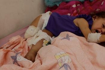 La niña palestina Maryam Abu ‘Alba yace en una cama de hospital en Gaza; su pierna derecha ha sido amputada y la izquierda está gravemente herida.