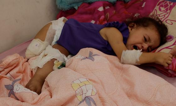Driven by hunger in Gaza, amputees are part of the collateral damage thumbnail
