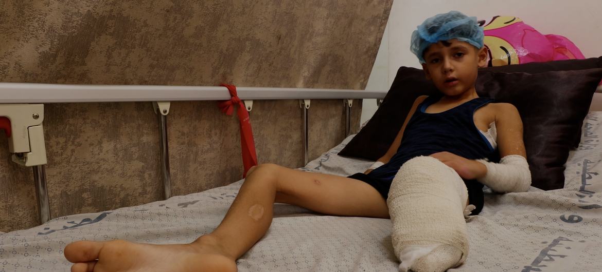 Palestinian child Mohammad Hassan sitting on a hospital bed in Gaza after his left leg was amputated by a strike.