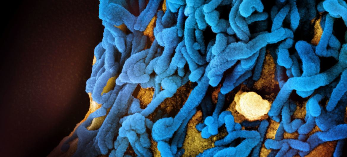 马堡病毒颗粒（蓝色）的彩色扫描电子显微镜图像。