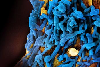 马堡病毒颗粒（蓝色）的彩色扫描电子显微镜图像。