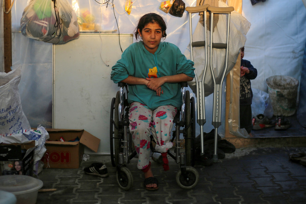 رزان طفلة فلسطينية (11 عاما) فقدت والديها وأشقاءها في الحرب في غزة. أصيبت في أعمال قصف واضطر الأطباء إلى بتر ساقها في ظل الافتقار للعلاج المناسب.