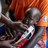 A woman brings her severely malnourished child to a WFP nutrition site in Torit, South Sudan.