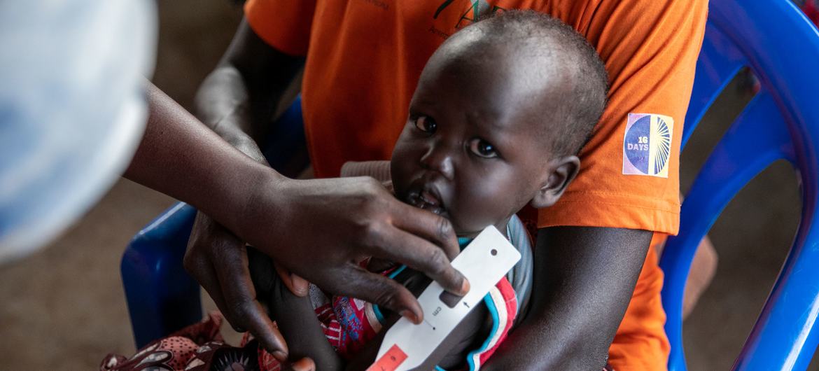 امرأة تأتي بطفلها المصاب بسوء التغذية الحاد إلى موقع للتغذية تابع لبرنامج الأغذية العالمي في توريت ، جنوب السودان.