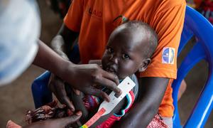 A woman brings her severely malnourished child to a WFP nutrition site in Torit, South Sudan.