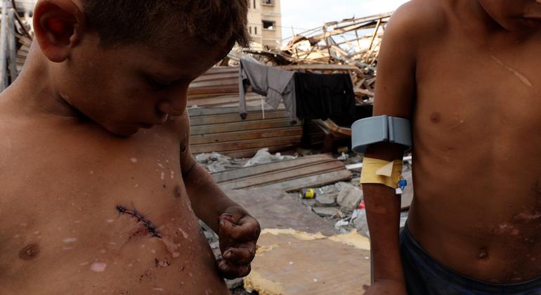 جود کیمرے کے سامنے اپنے ہاتھ دکھاتے ہوئے بتاتا ہے کہ ان پر بھی چھروں کے نشانات ہیں جو اس روز دھماکے کے نتیجے میں لگے۔