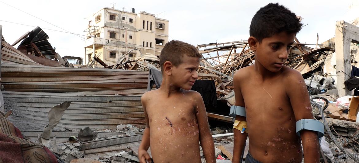 الطفلان زين وجود من عائلة الأنقر مصابان بجروح ظاهرة جراء انفجار جسم من مخلفات الحرب في غزة.