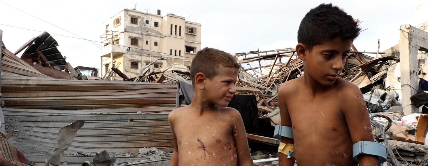 Dos niños, Zain y Jude, de la familia Al-Anqar, con heridas visibles causadas por la explosión de un artefacto sospechoso de guerra en Gaza.