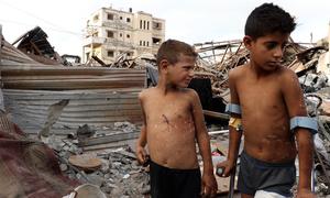 Dos niños, Zain y Jude, de la familia Al-Anqar, con heridas visibles causadas por la explosión de un artefacto sospechoso de guerra en Gaza.