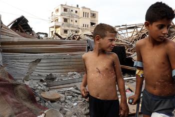 الطفلان زين وجود من عائلة الأنقر مصابان بجروح ظاهرة جراء انفجار جسم من مخلفات الحرب في غزة.