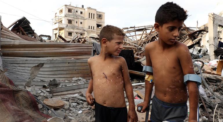 "انفجار بين الركام"، شقيقان من غزة يرويان لحظات تركت ندوبا غائرة على جسديهما