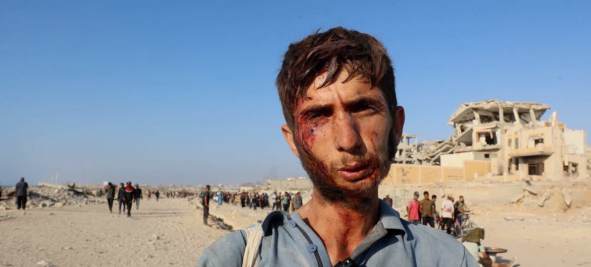 A young Gazan was injured while trying to obtain aid. A young Gazan was injured while trying to obtain aid.