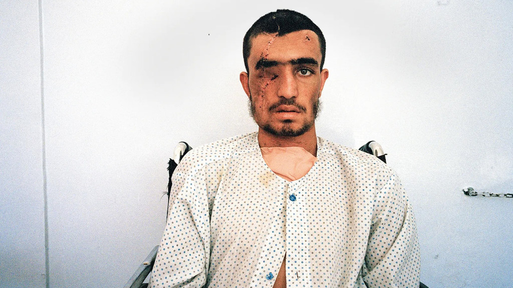 Мохаммад в больнице Кабула, Афганистан. Ему выстрелили в голову.