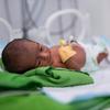 A premature baby receives care at a hospital in Al-Mukalla City in Yemen. 