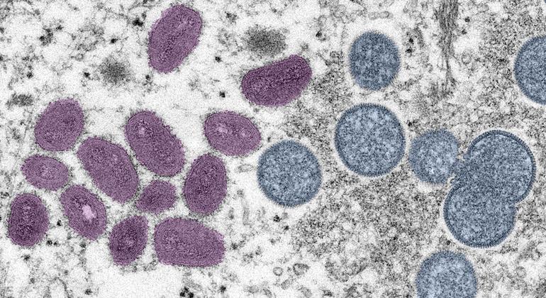 A varíola M é uma infecção rara, mas perigosa, semelhante ao agora erradicado vírus da varíola