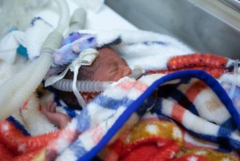 在埃塞俄比亚一家医院的新生儿重症监护室，一名刚出生一天的早产儿正在全天候后接受救治。