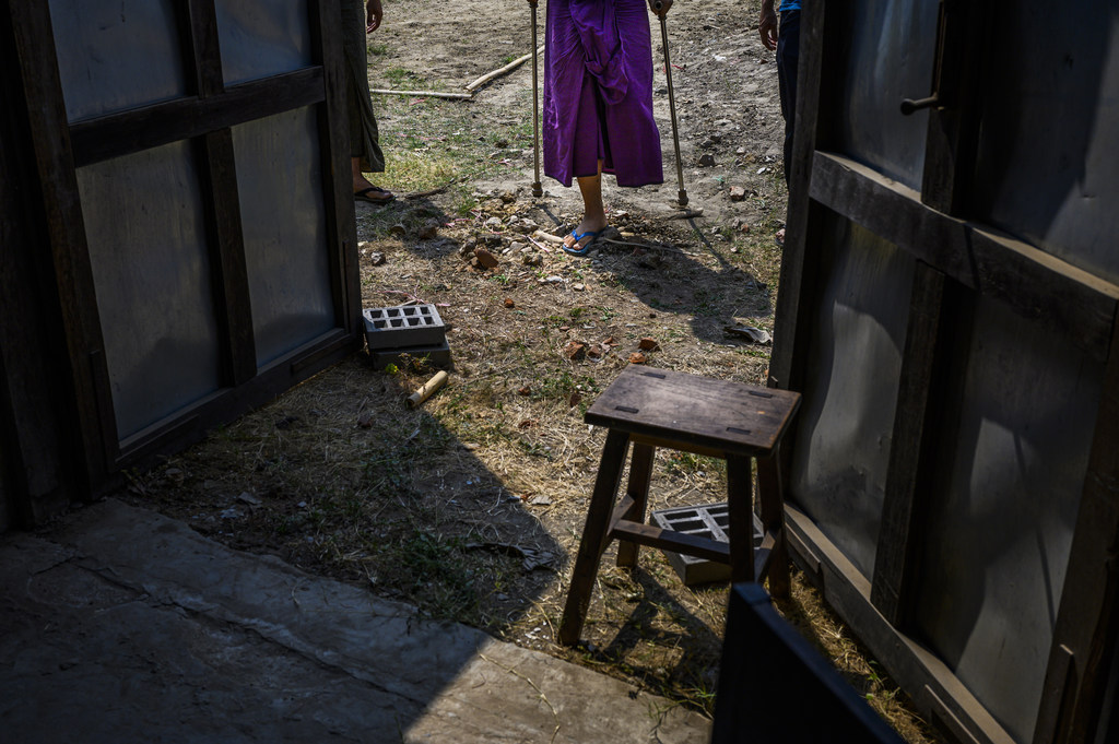Un niño con una pierna protésica permanece de pie frente a una estructura de madera en una zona rural de Myanmar.