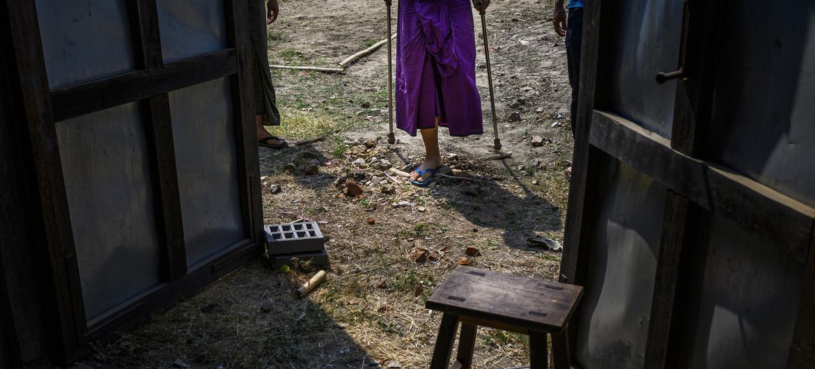 A child who lost his left leg after accidentally stepping on a landmine in his family's paddy fields in central Myanmar.