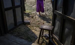 A child who lost his left leg after accidentally stepping on a landmine in his family's paddy fields in central Myanmar.