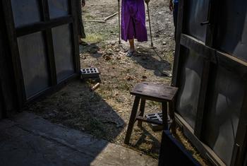 A child who lost his left leg after accidentally stepping on a landmine in his family's paddy fields in central Myanmar.