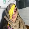Un mujer anciana palestina herida en un ojo tras un ataque del Ejército de israel.