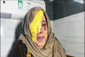 Un mujer anciana palestina herida en un ojo tras un ataque del Ejército de israel.