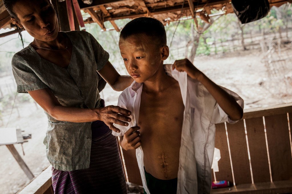 Un garçon blessé par un engin non explosé dans l'État de Kayin, au Myanmar (archives)