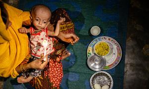 Un niño desnutrido recibe alimentos en un refugio de un asentamiento de refugiados en Cox's Bazar, Bangladesh.