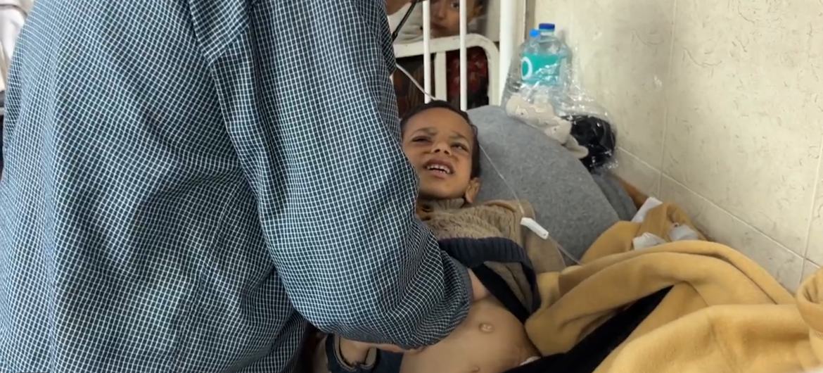 Семилетний Омар получает медицинскую помощь от недоедания в Газе.