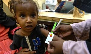 Una niña recibe tratamiento para la desnutrición en el hospital saudita de Omdurman, en el estado de Jartún, en Sudán.
