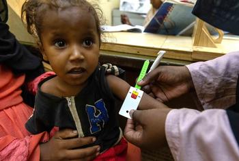 Una niña recibe tratamiento para la desnutrición en el hospital saudita de Omdurman, en el estado de Jartún, en Sudán.