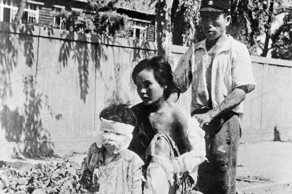 Выжившие в ядерной бомбардировке Хиросимы. 