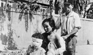 Survivants de la bombe d'Hiroshima ayant reçu des soins médicaux. (archives)