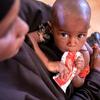 Un enfant est tenu par sa mère alors qu'il se nourrit d'un sachet d'aliments thérapeutiques prêts à l'emploi en Somalie.