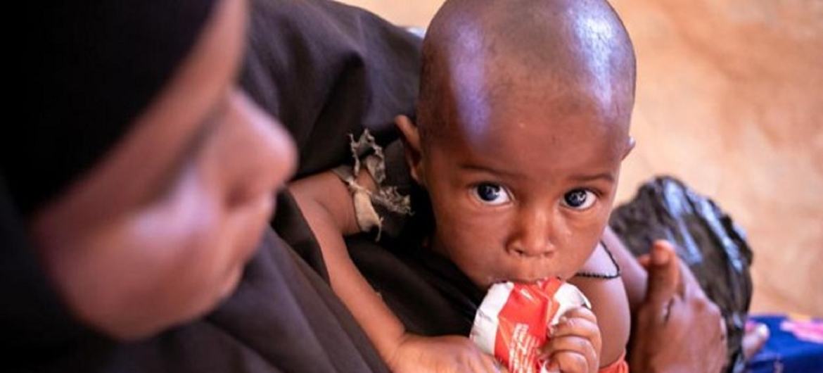 A child is held by his mother as he feeds on a sachet of ready-to-use therapeutic food in Somalia.
