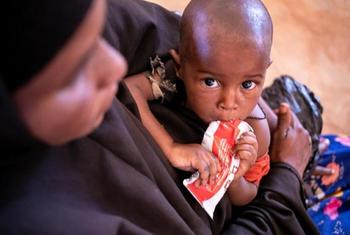 A child is held by his mother as he feeds on a sachet of ready-to-use therapeutic food in Somalia.