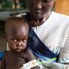 दक्षिण सूडान के जुबा में अल सब्बाह चिल्ड्रन्स हॉस्पिटल में अफरा, उसकी मां थेरेसी द्वारा आयोजित कुपोषण के लिए जाँच की जा रही है